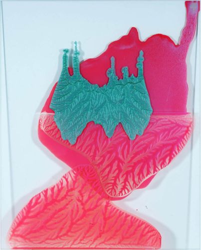 <p>DOPAMINFALLE / &Ouml;l auf und hinter Glas / 82x70 cm / 2025,26</p>
